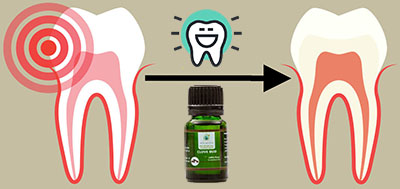 clove essential oil for toothache